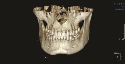 DEXIS OP 3D